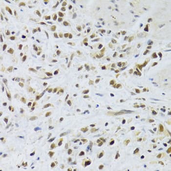 Polyclonal Rabbit anti-Human RAD50 Antibody (IHC, WB)