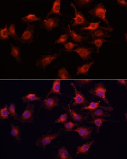 Polyclonal Rabbit anti-Human VEGFA / VEGF Antibody (IF, WB)