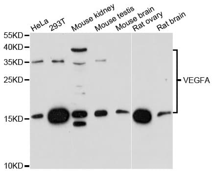 Polyclonal Rabbit anti-Human VEGFA / VEGF Antibody (IF, WB)
