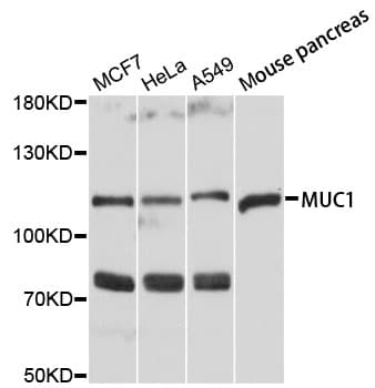 Polyclonal Rabbit anti-Human EMA / MUC1 Antibody (WB)