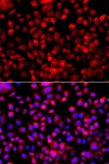FASN / Fatty Acid Synthase Antibody