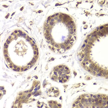Polyclonal Rabbit anti-Human HDAC5 Antibody (IHC, IF, WB)