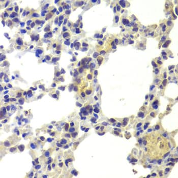 Polyclonal Rabbit anti-Human HDAC5 Antibody (IHC, IF, WB)