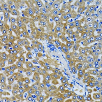 Polyclonal Rabbit anti-Human HDAC5 Antibody (IHC, IF, WB)