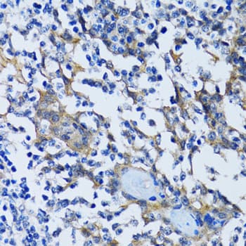 Polyclonal Rabbit anti-Human HDAC5 Antibody (IHC, IF, WB)