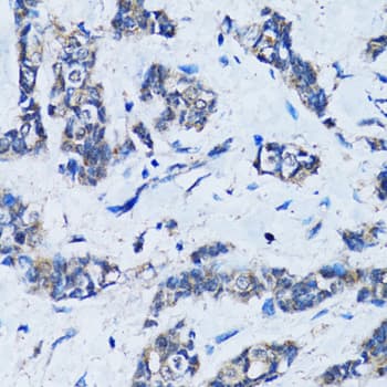 Polyclonal Rabbit anti-Human HDAC5 Antibody (IHC, IF, WB)