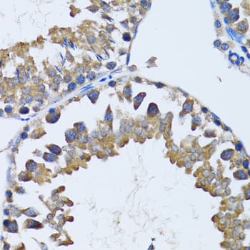 Polyclonal Rabbit anti-Human HDAC5 Antibody (IHC, IF, WB)
