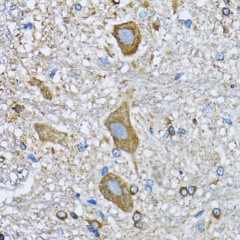 Polyclonal Rabbit anti-Human HDAC5 Antibody (IHC, IF, WB)