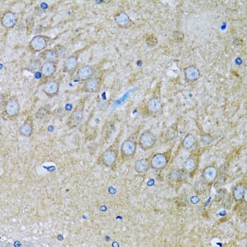 Polyclonal Rabbit anti-Human HDAC5 Antibody (IHC, IF, WB)