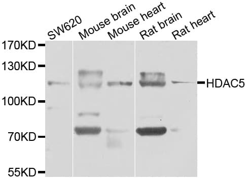 Polyclonal Rabbit anti-Human HDAC5 Antibody (IHC, IF, WB)