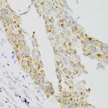 Polyclonal Rabbit anti-Human TEK / TIE2 Antibody (IHC, IF, WB)