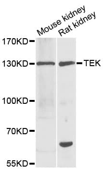 Polyclonal Rabbit anti-Human TEK / TIE2 Antibody (IHC, IF, WB)
