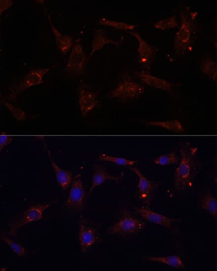 Polyclonal Rabbit anti-Human CTGF Antibody (IHC, IF, WB)