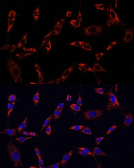 Polyclonal Rabbit anti-Human CTGF Antibody (IHC, IF, WB)