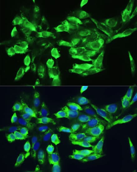 Polyclonal Rabbit anti-Human CTGF Antibody (IHC, IF, WB)