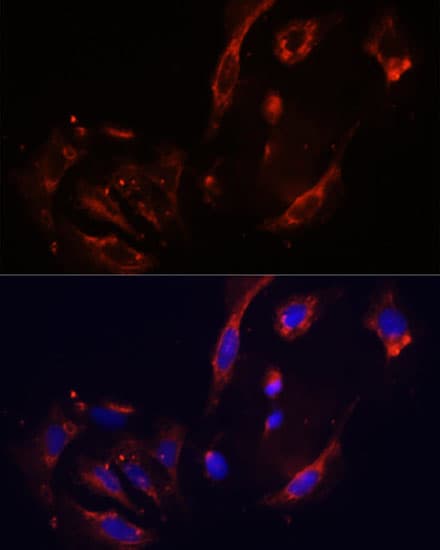 Polyclonal Rabbit anti-Human CTGF Antibody (IHC, IF, WB)