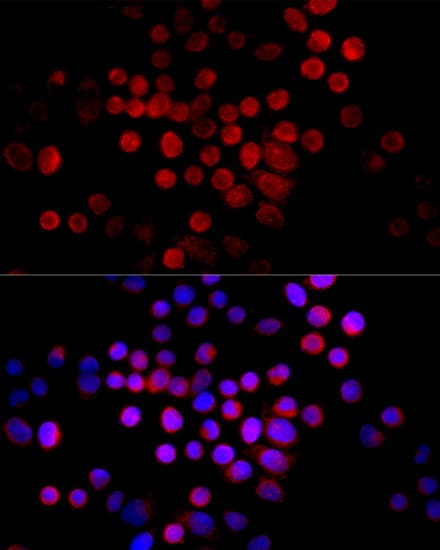 Polyclonal Rabbit anti-Human CTGF Antibody (IHC, IF, WB)