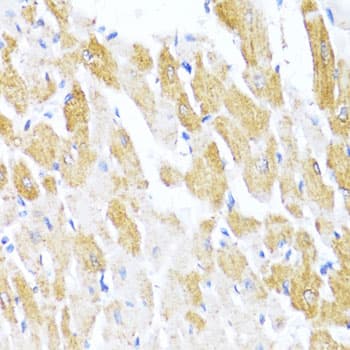 Polyclonal Rabbit anti-Human CTGF Antibody (IHC, IF, WB)
