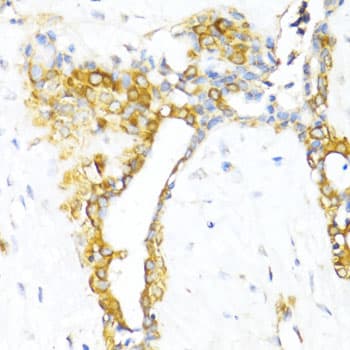 Polyclonal Rabbit anti-Human CTGF Antibody (IHC, IF, WB)
