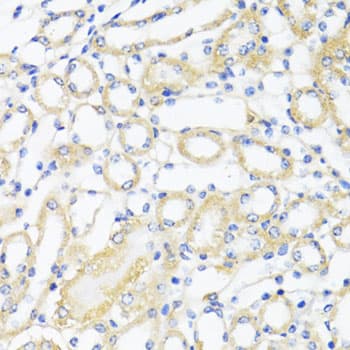 Polyclonal Rabbit anti-Human CTGF Antibody (IHC, IF, WB)