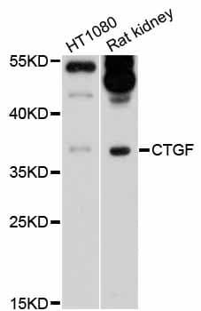 Polyclonal Rabbit anti-Human CTGF Antibody (IHC, IF, WB)