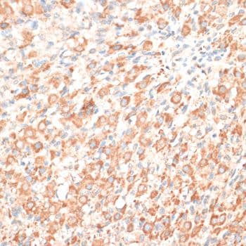EGFR Antibody