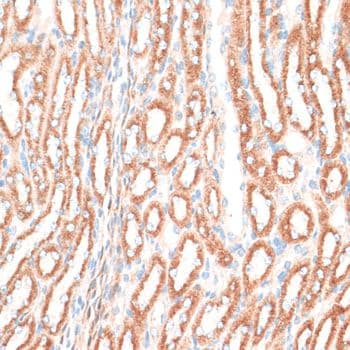 EGFR Antibody