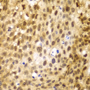 Polyclonal Rabbit anti-Human IRF3 Antibody (IHC, WB)