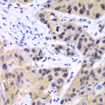 Polyclonal Rabbit anti-Human IRF3 Antibody (IHC, WB)
