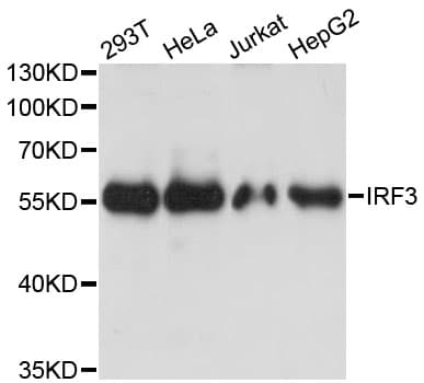 Polyclonal Rabbit anti-Human IRF3 Antibody (IHC, WB)