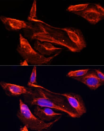 Polyclonal Rabbit anti-Human MMP2 Antibody (IHC, IF, WB)