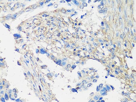 Polyclonal Rabbit anti-Human MMP2 Antibody (IHC, IF, WB)