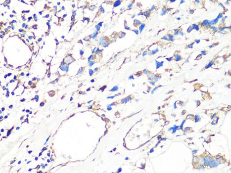 Polyclonal Rabbit anti-Human MMP2 Antibody (IHC, IF, WB)