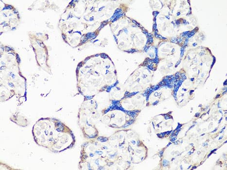 Polyclonal Rabbit anti-Human MMP2 Antibody (IHC, IF, WB)