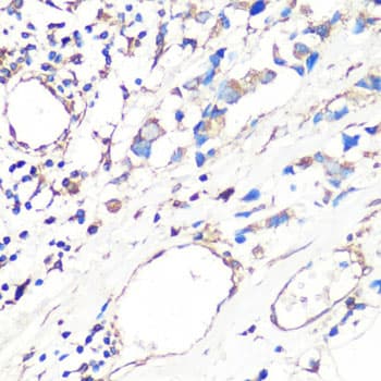 Polyclonal Rabbit anti-Human MMP2 Antibody (IHC, IF, WB)