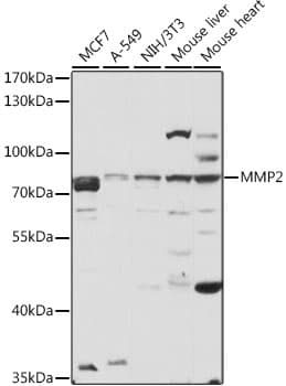 Polyclonal Rabbit anti-Human MMP2 Antibody (IHC, IF, WB)