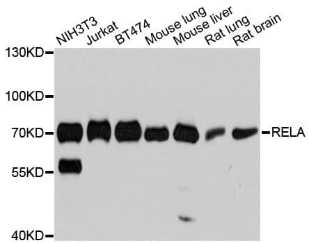 Polyclonal Rabbit anti-Human RELA / NFKB p65 Antibody (WB)