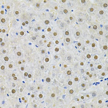 Polyclonal Rabbit anti-Human SQSTM1 Antibody (IHC, IF, WB)
