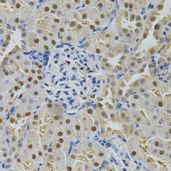 Polyclonal Rabbit anti-Human SQSTM1 Antibody (IHC, IF, WB)