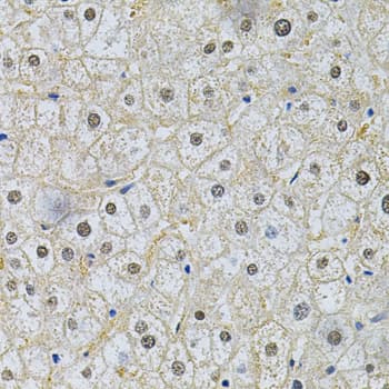 Polyclonal Rabbit anti-Human SQSTM1 Antibody (IHC, IF, WB)