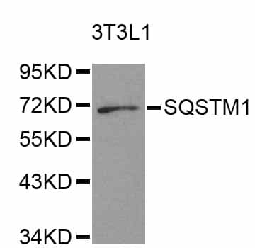 Polyclonal Rabbit anti-Human SQSTM1 Antibody (IHC, IF, WB)