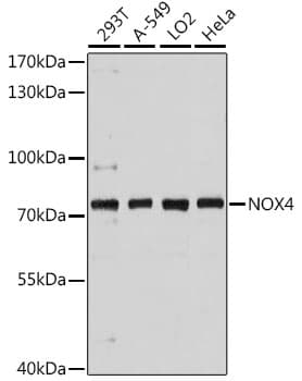 Polyclonal Rabbit anti-Human NOX4 Antibody (WB)