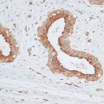 BCL2 / Bcl-2 Antibody