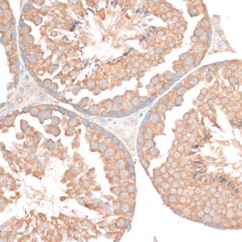 BCL2 / Bcl-2 Antibody