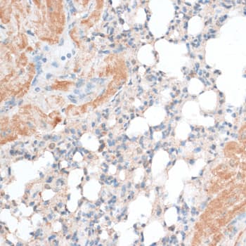 BCL2 / Bcl-2 Antibody