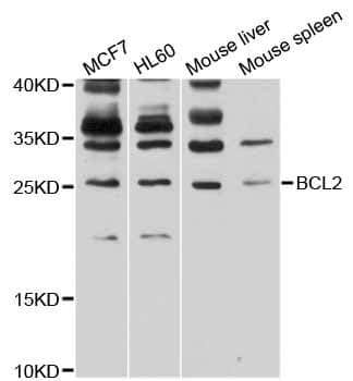 BCL2 / Bcl-2 Antibody