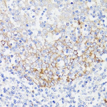 EGFR Antibody