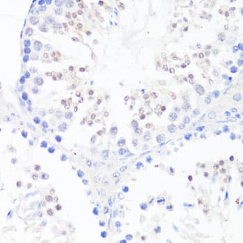 EGFR Antibody