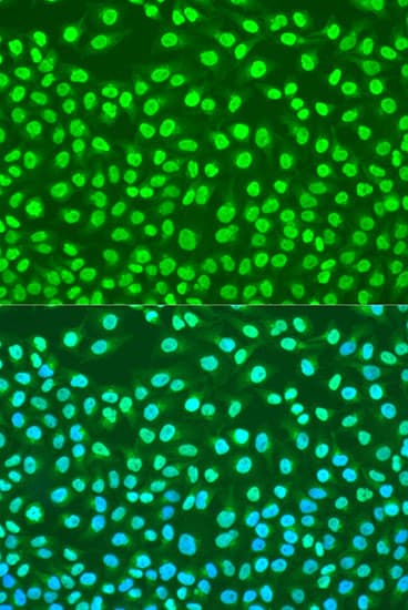 Polyclonal Rabbit anti-Human H2AFX / H2AX Antibody (IHC, IF, WB)