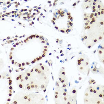 Polyclonal Rabbit anti-Human H2AFX / H2AX Antibody (IHC, IF, WB)